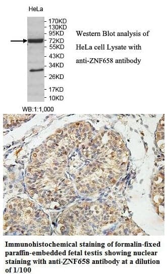 Anti-ZNF658
