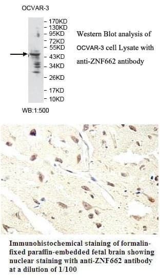 Anti-ZNF662