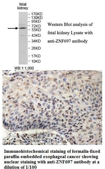 Anti-ZNF697