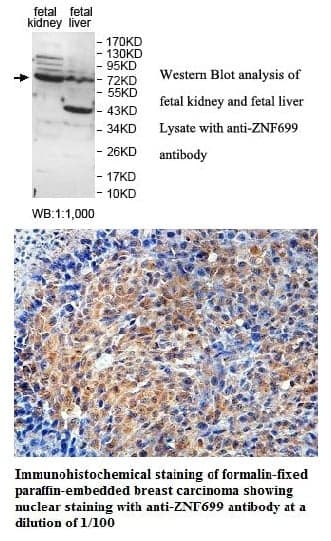 Anti-ZNF699