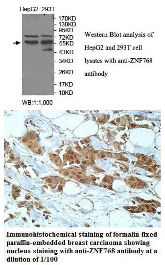 Anti-ZNF768