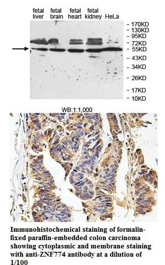 Anti-ZNF774