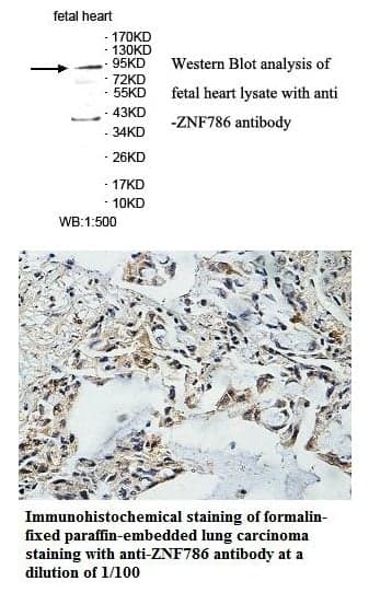 Anti-ZNF786
