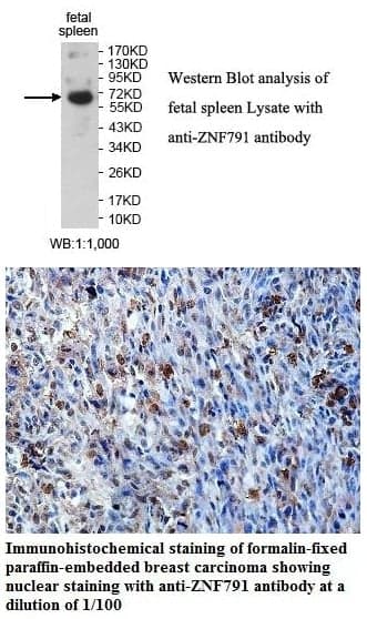 Anti-ZNF791