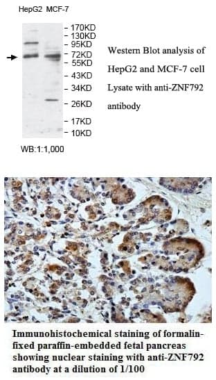 Anti-ZNF792