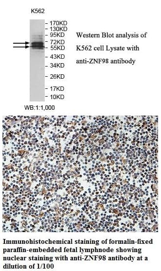 Anti-ZNF98